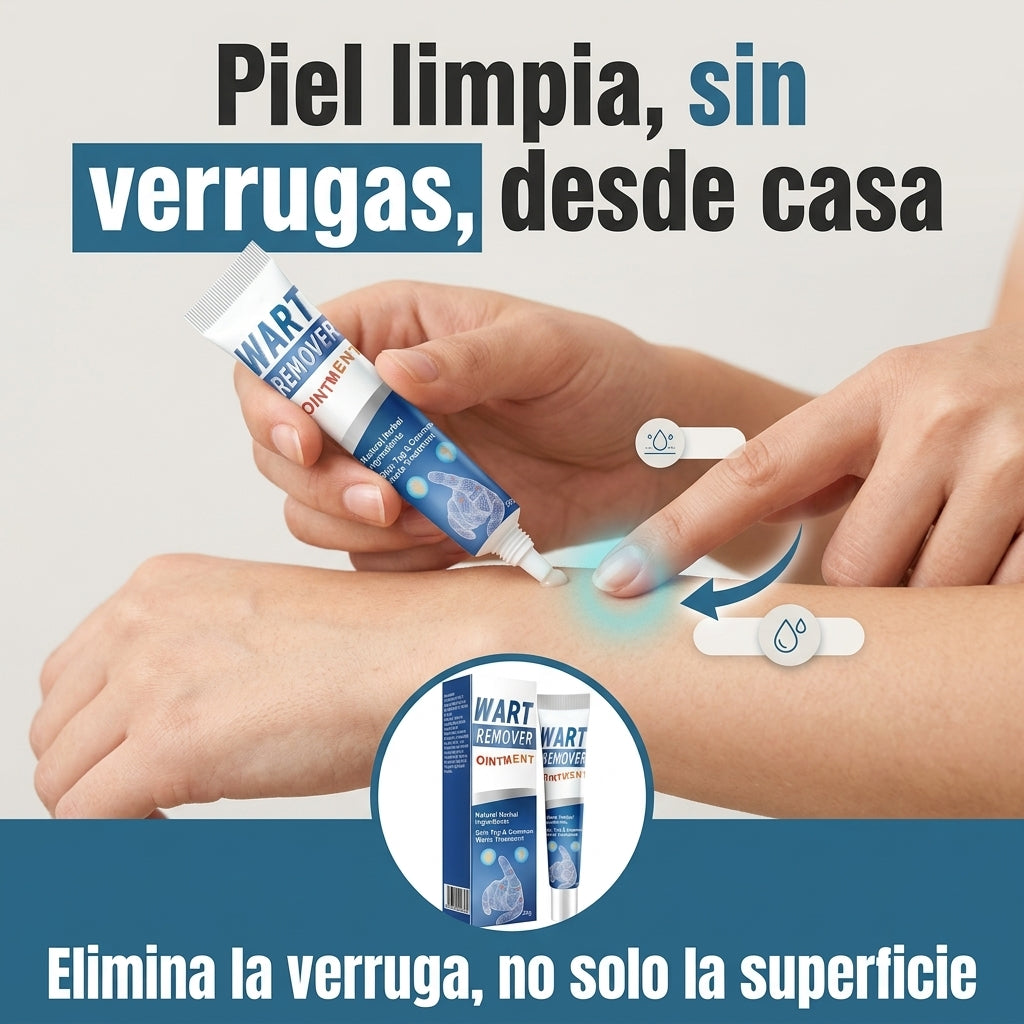 Wart Removedor Definitivo