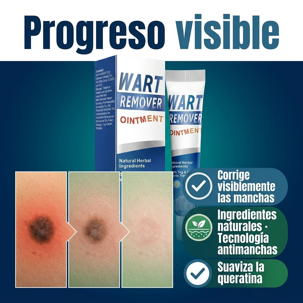 Wart Removedor Definitivo