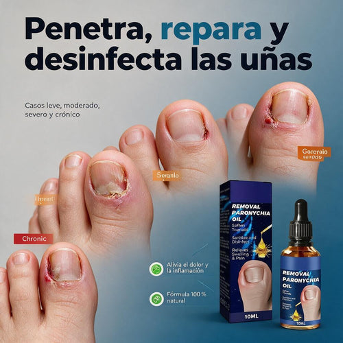 Aceite Restaurador de Uñas 3 en 1