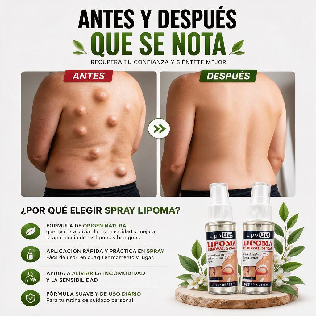 Lipo-Out Spray Natural