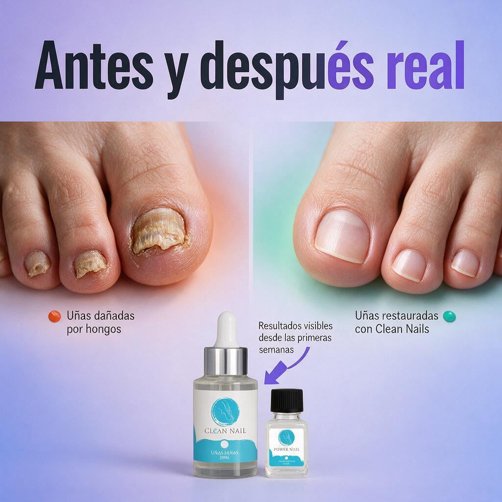 Restauración de Uñas Cristal