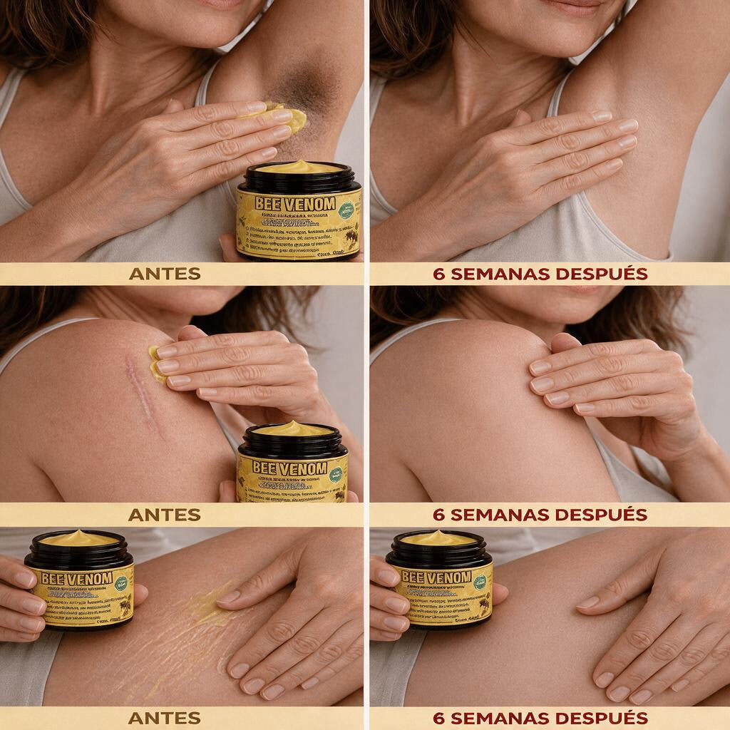 Crema Apitoxina Repair
