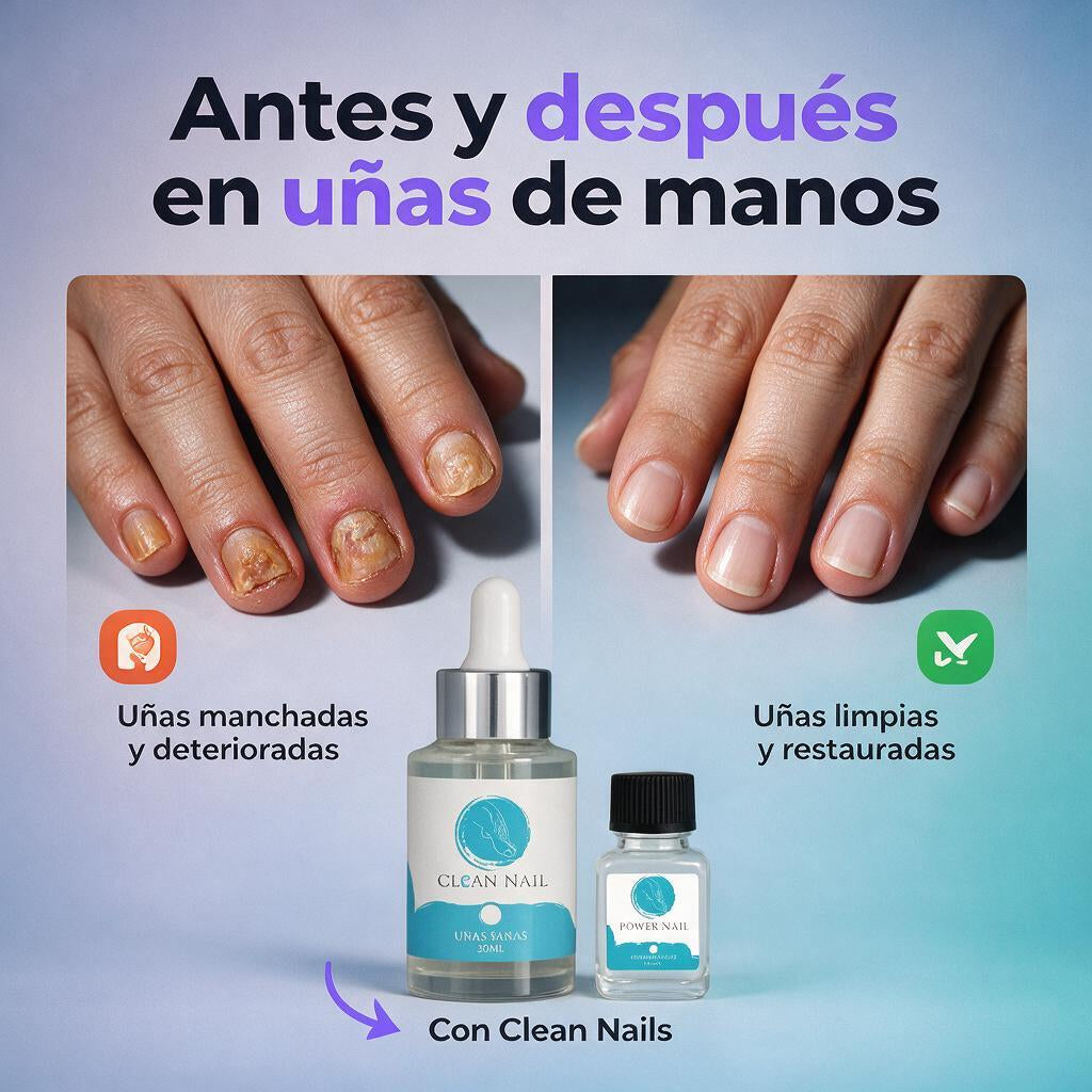 Restauración de Uñas Cristal